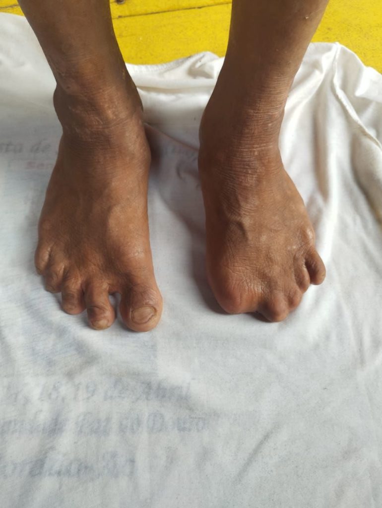 Vídeo mostra indígena sendo “disciplinado” por facção e caso é investigado no interior do Acre